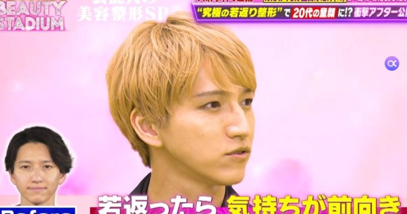 田口淳之介、KAT-TUN脱退10年で整形ドキュメンタリー出演して若返りビフォーアフター公開w